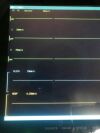 ROHS ICU Patient Monitor ECG NIBP SpO2 RESP TEMP HR Touch Screen 15" NEW in Box Monitor