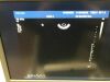 PHILIPS C9-5ec Ultrasound Transducer