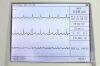 SCHILLER CARDIOVIT AT-102 ECG unit