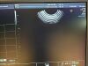 GE RIC5-9-D Ultrasound Transducer