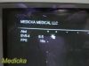 SIEMENS 2009  EV9-4 P/N 08647500 Endocavity Ultrasound Transducer Probe Ultrasound Transducer