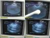 SIEMENS 2009  EV9-4 P/N 08647500 Endocavity Ultrasound Transducer Probe Ultrasound Transducer