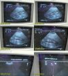 SIEMENS C4-2 Model 08647567 Convex Array Ultrasound Transducer Probe Ultrasound Transducer
