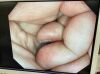 OLYMPUS GIF-HQ290 Gastroscope