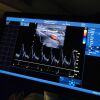 GE VIVID E95 4d Ultrasound - Cardiac - Vascular