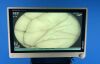 FUJINON EG-600ZW Gastroscope Endoscope