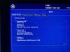 GE Vivid E9 With XD Clear Ultrasound - Cardiac