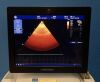 GE Vivid E9 With XD Clear Ultrasound - Cardiac