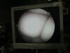 LINVATEC QL4700 Arthroscope