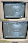 SIEMENS 2009  EV9-4 Model 08647500 Endocavity Ultrasound Transducer Probe Ultrasound Transducer