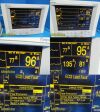 DATASCOPE Passport XG 0998-00-0134-42 Patient Monitor