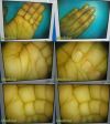 CONMED LINVATEC 1000E Rigid Telescope 10mmx0° Laparoscope