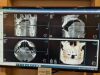POINTNIX Combi 500S Dental X-Ray