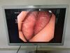 OLYMPUS GIF-Q180 Gastroscope