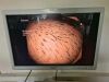 OLYMPUS GIF-Q180 Gastroscope