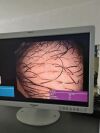 OLYMPUS BF-Q180 Bronchoscope