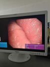 OLYMPUS BF-Q180 Bronchoscope