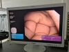 OLYMPUS BF-Q180 Bronchoscope
