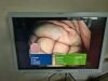 OLYMPUS CF-H180AL Colonoscope