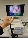OLYMPUS CF-Q180AL Colonoscope