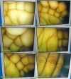 ACMI LAP 10-0 FDA, Rigid Telescope 10mm x 0°, Autoclavable ~ Laparoscope