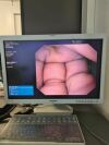 OLYMPUS CF-Q160L Colonoscope