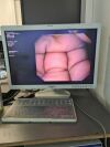 OLYMPUS GIF-Q160 Gastroscope