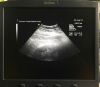 ACUSON 8C4 Ultrasound Transducer Probe Ultrasound Transducer