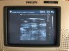 PHILLIPS/ATL ATL. L7-4 PHILIPS ATL Linear Array Transducer L4 Ultrasound Probe