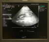 SIEMENS 4V1 Ultrasound Transducer