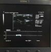 SIEMENS 17L5 Ultrasound Transducer