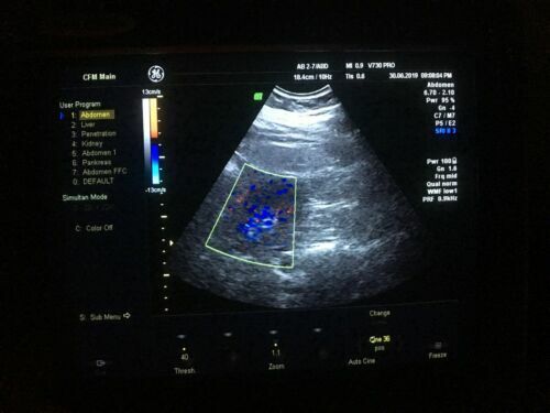 GE AB2-7 Curved Array Abdominal Probe Transducer Ultrasound Transducer