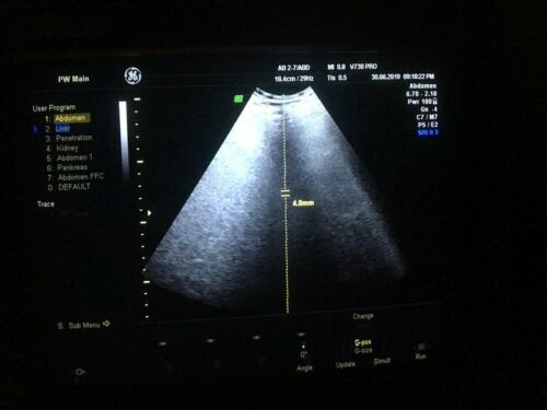 GE AB2-7 Curved Array Abdominal Probe Transducer Ultrasound Transducer