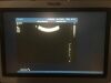 PHILIPS Ultrasound Transducer Probe 3D6-2 for iU22 / iE33 Ultrasound Ultrasound Transducer