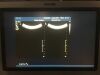 PHILIPS Ultrasound Transducer Probe 3D6-2 for iU22 / iE33 Ultrasound Ultrasound Transducer