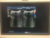 PHILIPS Ultrasound Transducer Probe 3D6-2 for iU22 / iE33 Ultrasound Ultrasound Transducer