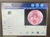 KARL STORZ 202045 20 SCB AIDA Karl   DVD-M  SmartScreen Image management System