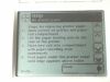 BAYER HEALTHCARE Clinitek Status Urine Analyzer