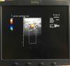 SIEMENS 15L8W Ultrasound Transducer