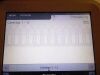 LUMINEX Nanosphere Verigene 10-0000-02 Virus & Bacteria Identification Analyzer