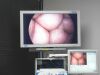 CONMED IM 8000 VIDEO ARTHROSCOPY TOWER
