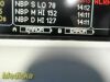 GE Dinamap Dash 3000 , W/ Masimo Set SpO2, ECG & NBP Leads ~ Patient Monitor