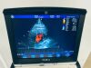 GE Vivid Q YOM 2014 Ultrasound - Cardiac