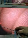 KARL STORZ 7200CW This is an offer for a Storz arthroscope , Hopkins 4 mm , 70 degree in excellent condition