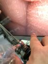 KARL STORZ 26004 BA This is an offer for a Storz arthroscope ,  3 mm , 30 degree in excellent condition