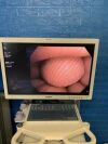 OLYMPUS BF-H190 Bronchoscope