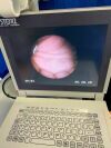 KARL STORZ 11004BI1 Bronchoscope