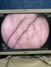 FUJINON EC-600ZW/M Colonoscope