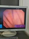 OLYMPUS TJF-Q180V Duodenoscope