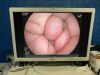 FUJINON EG-580RD Gastroscope